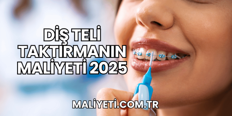 Diş Teli Taktırmanın Maliyeti 2025