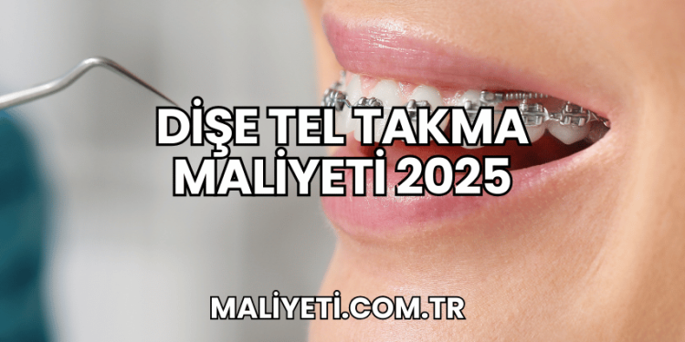 Dişe Tel Takma Maliyeti 2025