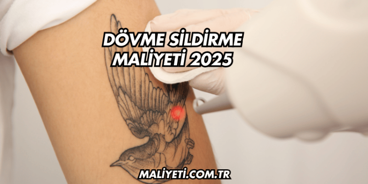 Dövme Sildirme Maliyeti 2025