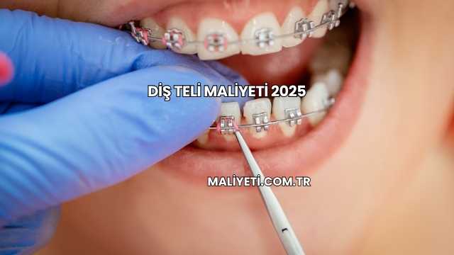 Diş Teli Maliyeti 2025
